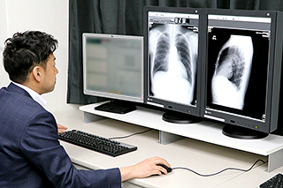 胸部レントゲン写真のダブルチェックシステム